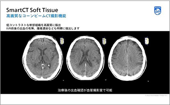 血管撮影装置（2方向撮影可能）「Azurion7 B20/12」
