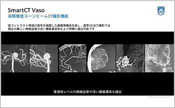 血管撮影装置（2方向撮影可能）「Azurion7 B20/12」